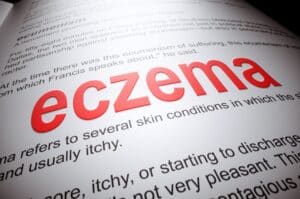 Un journal qui a pour titre eczema