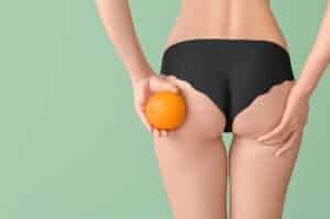 L'effet peau d'orange peut être réduit par la gemmothérapie