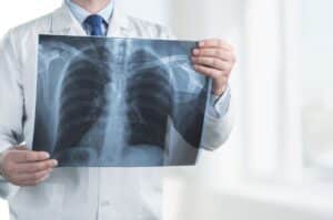 Un médecin qui observe les radios de poumons